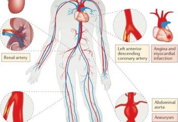 Cardiovascular Health and Longevity: Any Connection?