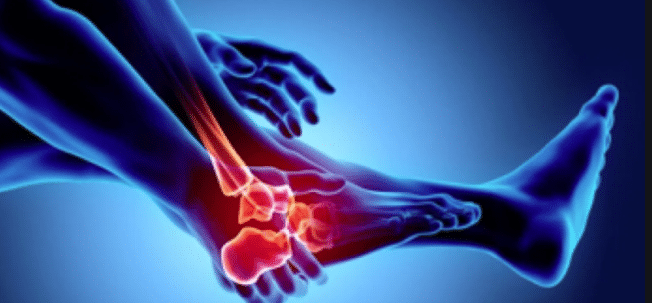 Arthritis: types, symptoms and treatment