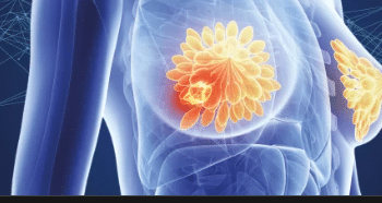 15 Cancer Symptoms to Know￼