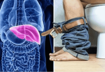 Liver disease: The warning signs when you visit the restroom – ‘Tell your doctor’