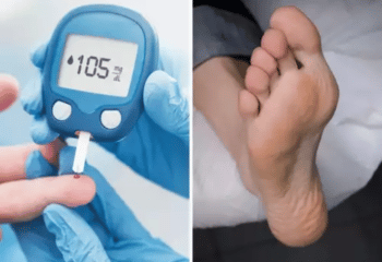 Diabetes In Your Feet: Seven Signs That Indicate High Blood Sugar Levels