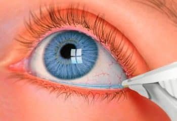 The Eye: Common Diseases, Vision Problems and Treatment