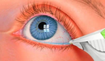 The Eye: Common Diseases, Vision Problems and Treatment