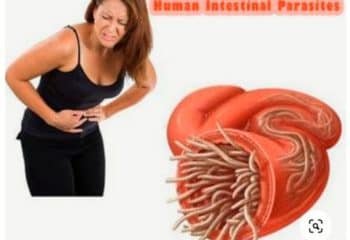 Home remedies to get rid of intestinal worms
