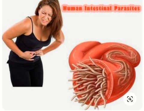 Home remedies to get rid of intestinal worms