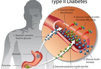 The lie that nothing can reverse type 2 diabetes – Coach Okechukwu