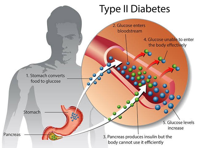 The lie that nothing can reverse type 2 diabetes – Coach Okechukwu