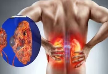 Strange Symptoms of Kidney Damage