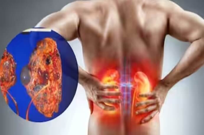 Strange Symptoms of Kidney Damage