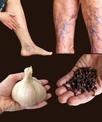 How To Treat Rheumatism, Varicose Veins With Garlic and Black Pepper