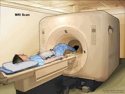 Much to Know About Magnetic Resonance Imaging
